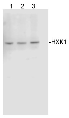 Western blot using anti-HXK1 (Chlamydomonas)